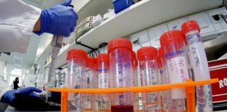 Confirman dos casos de Coronavirus en Oaxaca