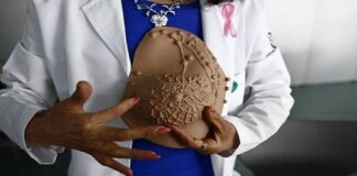 Fármaco contra tumores de mama, eficaz en cáncer de próstata avanzado