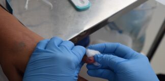 Discriminación a personas con VIH, viola sus derechos humanos: Coesida