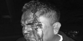 Policía municipal de Astata agrede a enfermero