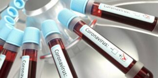 CDMX quiere 100,000 pruebas al mes para rastrear cadenas de contagio de Covid-19