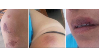 Reinstalan a funcionario de Santa Lucía del Camino que golpeó a una mujer