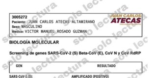 Confirman que edil de Salina Cruz da positivo a prueba de COVID-19