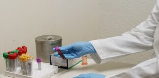 Importante que parejas estables se realicen la prueba del VIH: Coesida