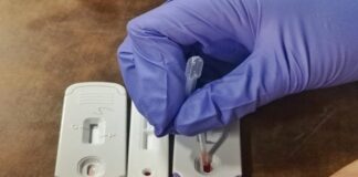 Invita Coesida a realizarse pruebas de detección del VIH, Sífilis y VHC