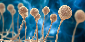 Detectan otro caso de Hongo Negro en Oaxaca, se reportó en Tuxtepec