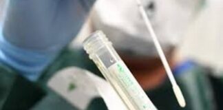 Alerta SSO por repunte de casos activos y hospitalizaciones por COVID-19