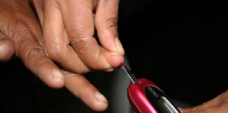 Pie diabético, principal causa de ingreso hospitalario en pacientes con diabetes