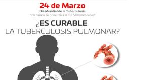 La prevención y control de la Tuberculosis, claves para su erradicación: SSO
