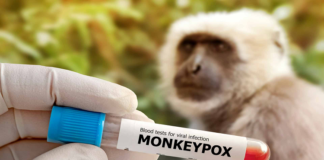 Contra viruela símica, exhortan SSO continuar con medidas sanitarias