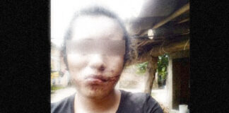 Agreden y le cortan la lengua a mujer trans en la Costa