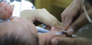 Reportan SSO caso probable de tétanos generalizado