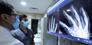 IMSS exhorta a prevenir la osteoporosis desde la niñez