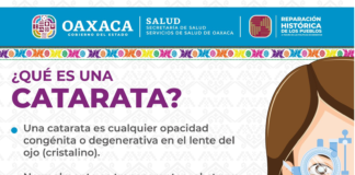 Realizarán Jornada de Detección de Catarata