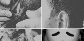 Perro ataca a un menor de edad en Cuilápam de Guerrero