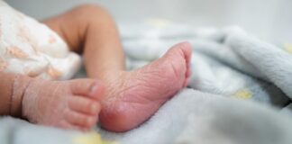 Ausencia de ácido fólico en la gestación puede causar espina bífida en recién nacidos: SSO