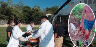 Perros de raza Pitbull atacan a niño dejándolo herido de gravedad