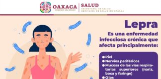 La lepra es prevenible y puede curarse con tratamiento